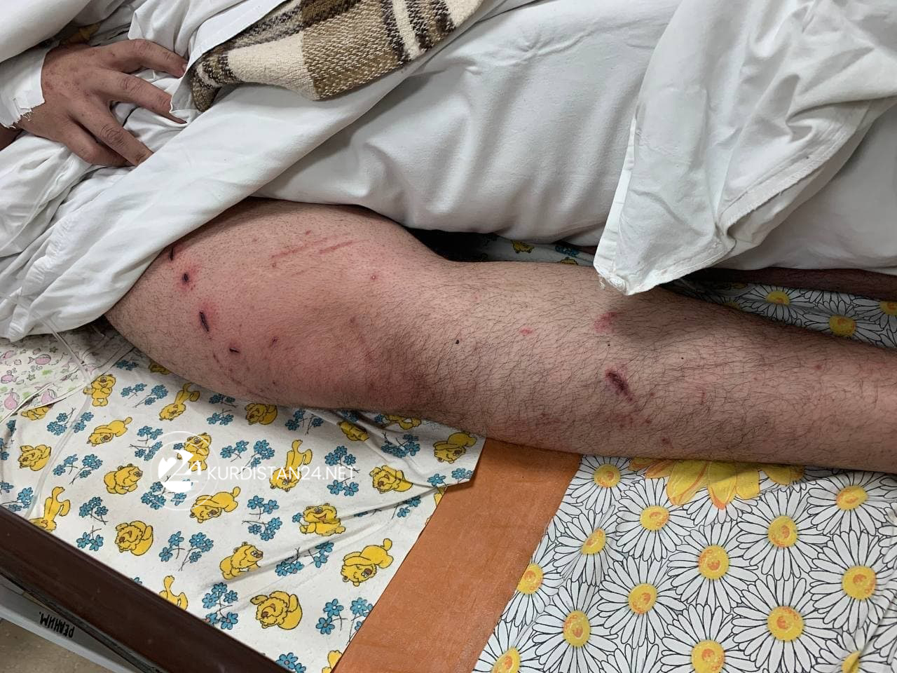 ده‌سه‌ڵاتدارانی پۆڵه‌ندا و لیتوانیا توندوتیژی به‌رامبه‌ر به‌ كۆچبه‌ران ده‌كه‌ن